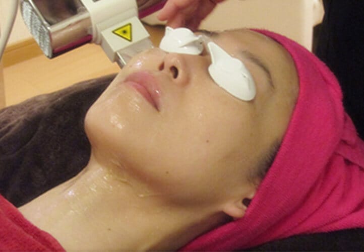 Photofacial